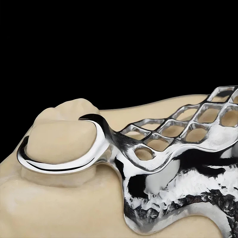 Dental Titanium Metal Framework