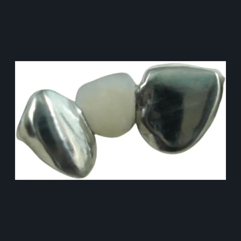 Moalr Teeth PFM Maryland Bridge