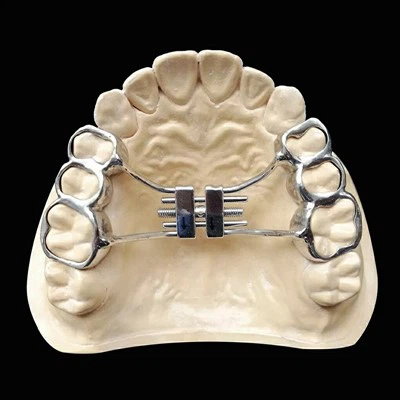 Wie reinige ich eine Dental Upper Quad Helix-Apparatur?