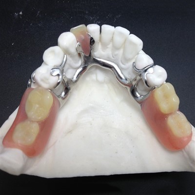 Darf ich bei Gerüstprothesen heiße Getränke trinken?